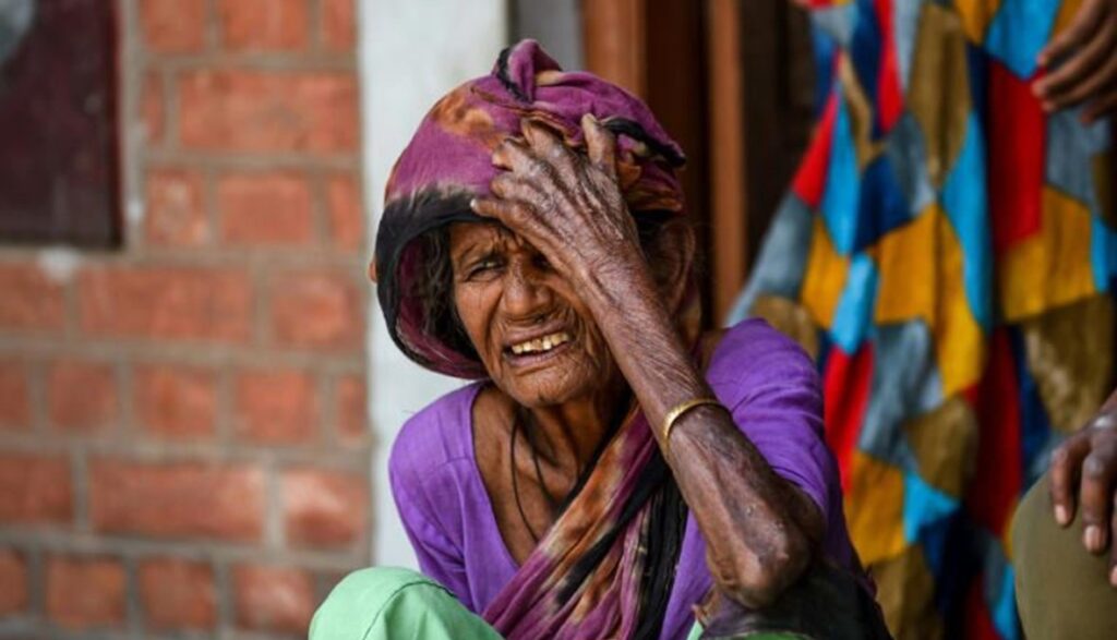 مرض الجذام لا يزال قائما … ومهم لا